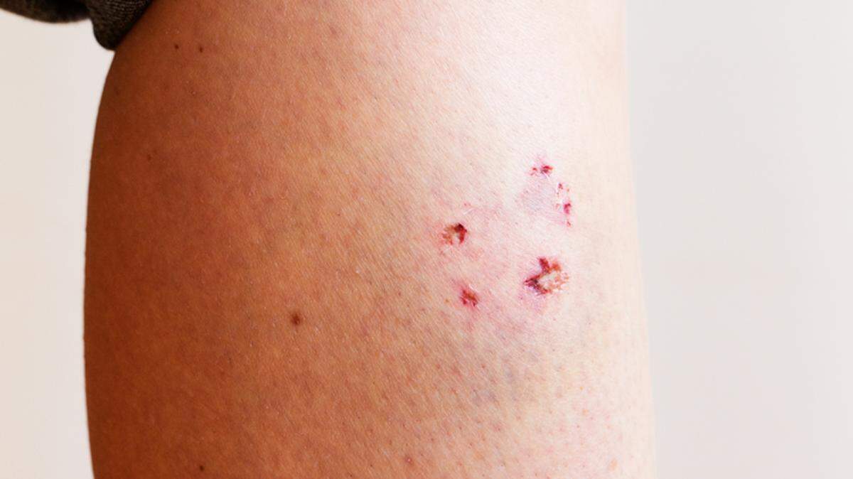 A study released by the Insurance Information Institute last week says claims for dog bites increased by 2.2 percent nationwide in 2017.