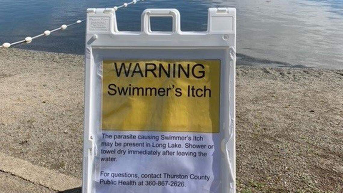 A sign at Long Lake Park in Lacey warns swimmers of a possible parasite in the water.