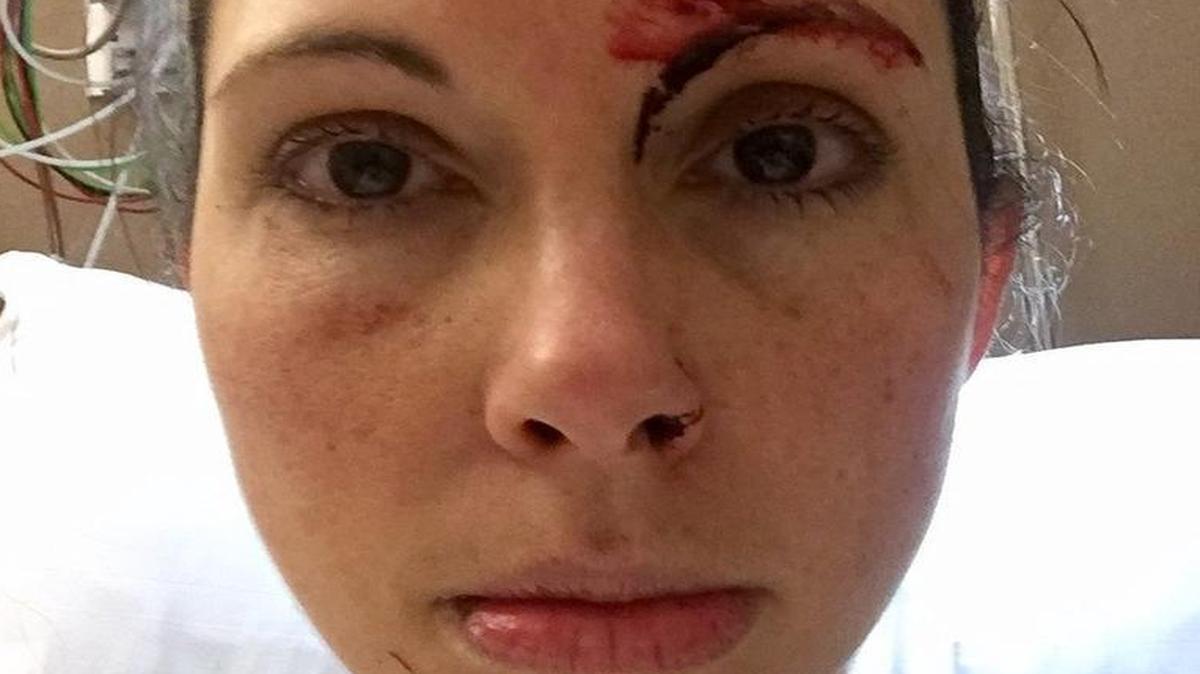 Kelly Herron the day she was attacked in the women’s restroom at Golden Gardens Park on March 5, 2017.